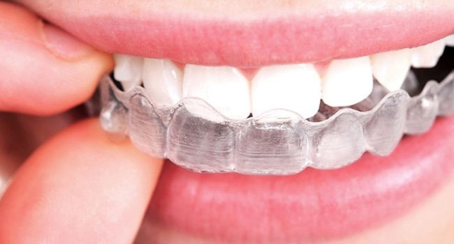 Şeffaf plak tedavisinin en büyük avantajı, özellikle de yetişkin hastalarımız için, neredeyse görünmez özellikte olmasıdır. Diş teli, braket vb. aygıtlar kullanılmadığı için, estetik olarak rahatsızlık duyulmasının önüne geçer.
